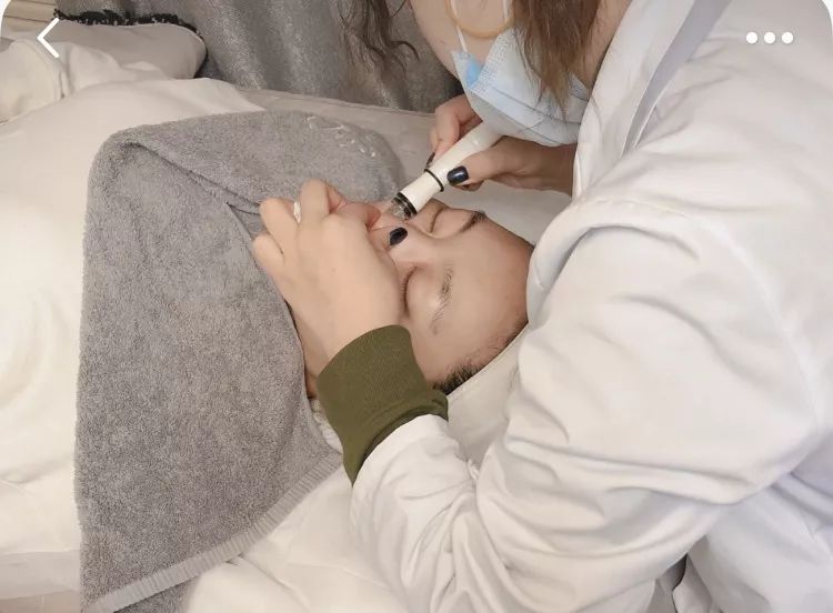 辣眼睛，有人用它吸出一整年的黑头，看完我果断下单了！