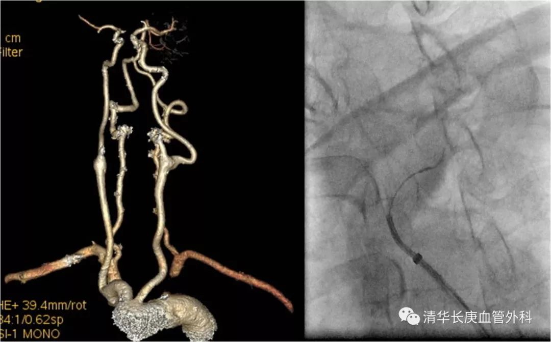 教学相长共同成长,北京清华长庚医院周围血管外科