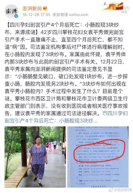 女子手术取出遗留纱布官方回应,女子手术留下纱布事件结果