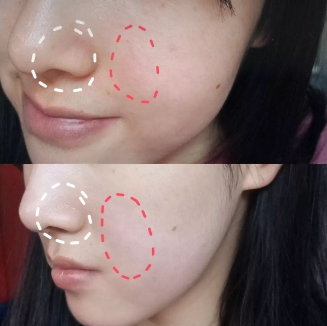 安瓶补水紧致提拉去皱精华,嫩白抗皱安瓶精华