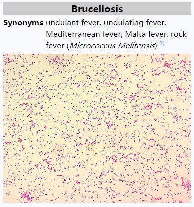 为什么体温计到42c了,为什么体温计刻度42
