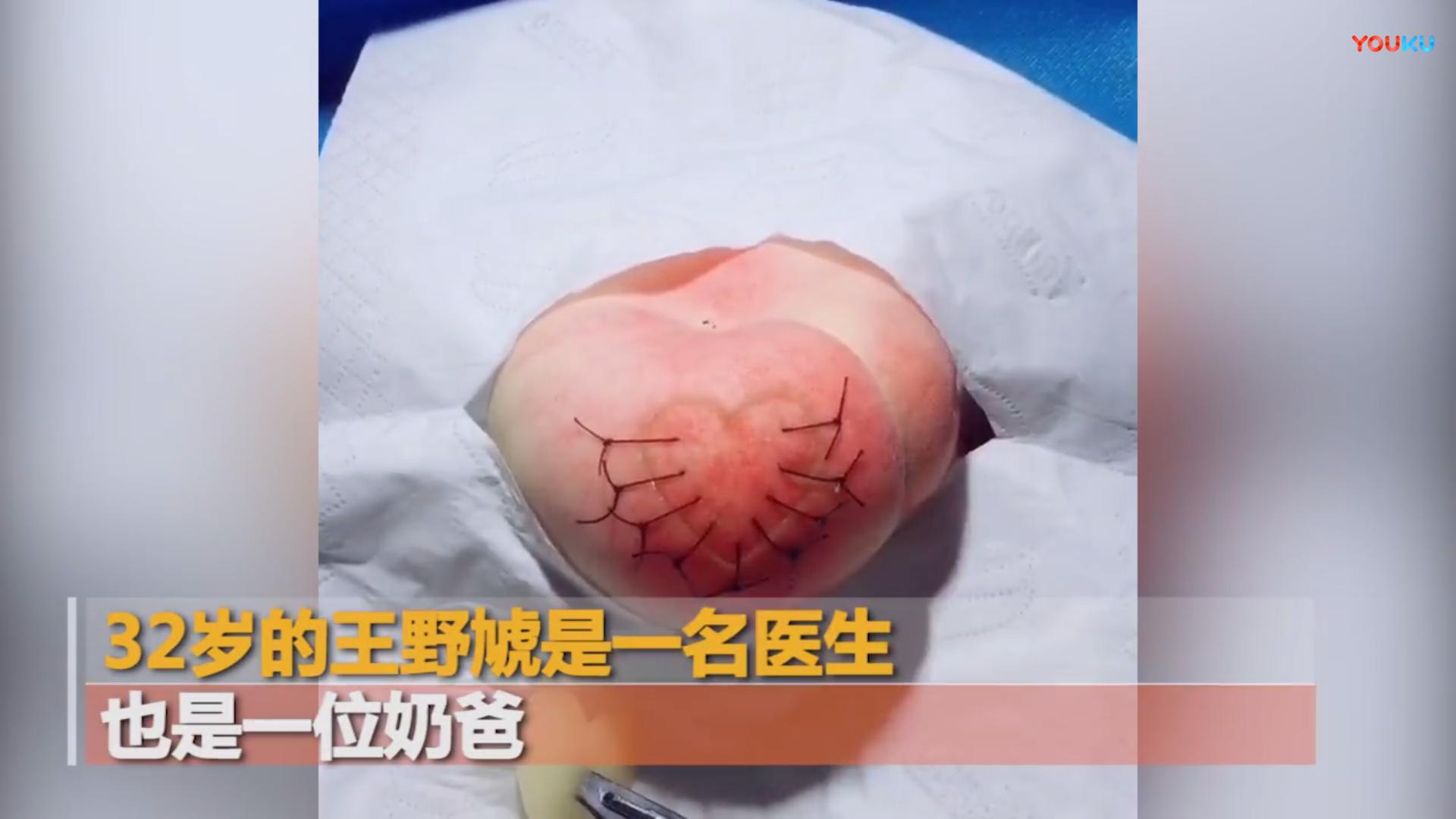 来者不拒！外科医生竟拿它们来练手