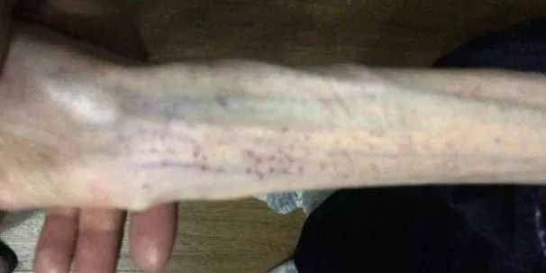 杭州高三女生3个月只吃黄瓜！结果出事了！妈妈泪崩：怎么劝都不听