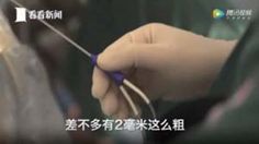 未婚女孩捐一次卵有危害吗,女性捐卵子对身体有伤害吗