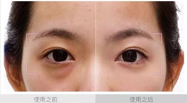 眼袋黑眼圈细纹抹一抹,去眼袋黑眼圈涂抹方法