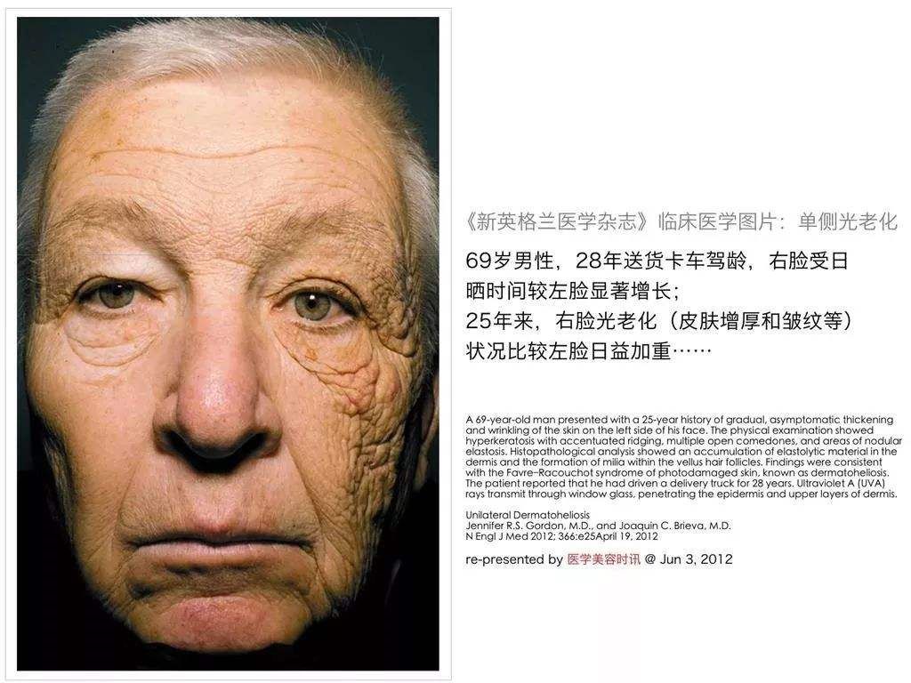 大s同款防晒帽真的管用吗,大s同款防晒帽正品