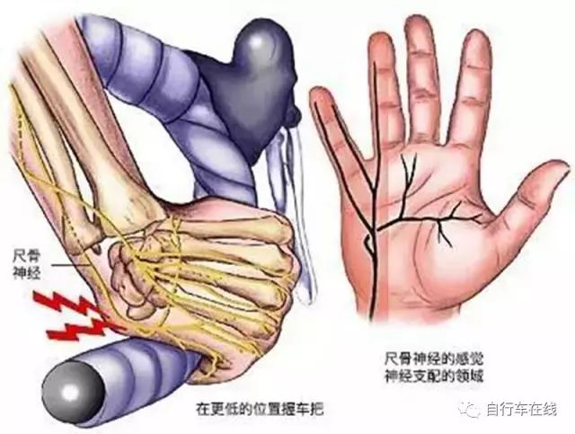骑行不戴口罩会有什么后果,骑行不戴手套危害有多大