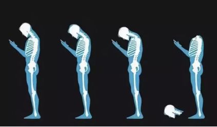 看电脑久了脖子酸疼怎么缓解,天天刷手机脖子痛