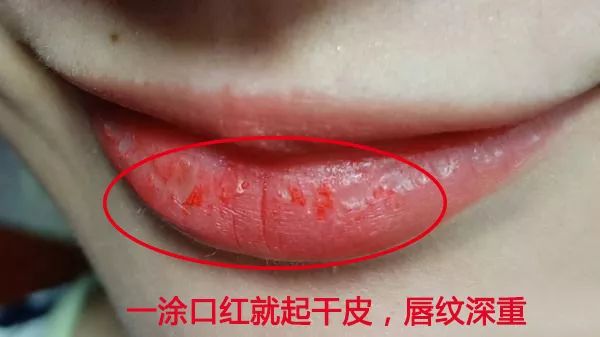 软化死皮淡化唇纹唇膜,唇霜去死皮淡化唇色