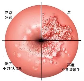 赶快叫上身边的姐妹们一起来健康检查吧
