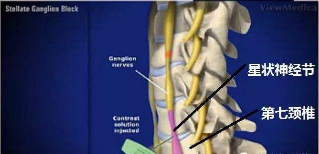 心悸胸闷头晕怎么回事,头晕心悸胸闷气短乏力嗜睡