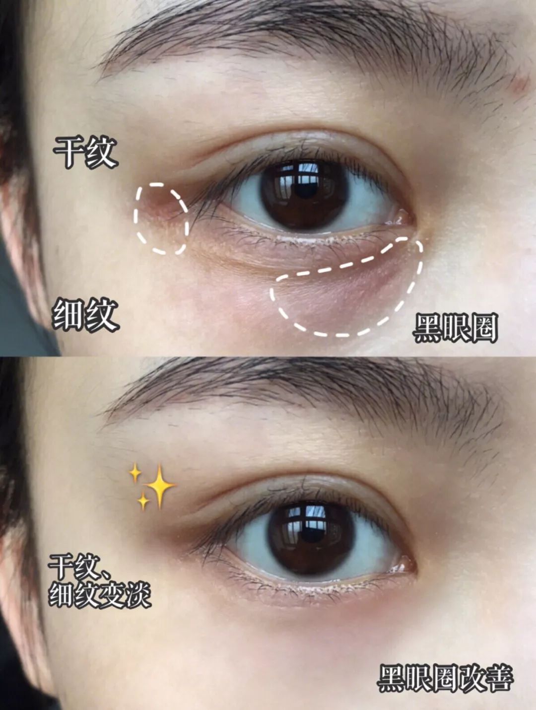 25岁必须用眼霜了吗,25岁之后合适用什么眼霜