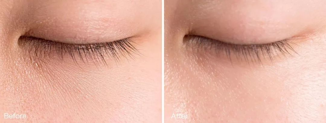 25岁必须用眼霜了吗,25岁之后合适用什么眼霜