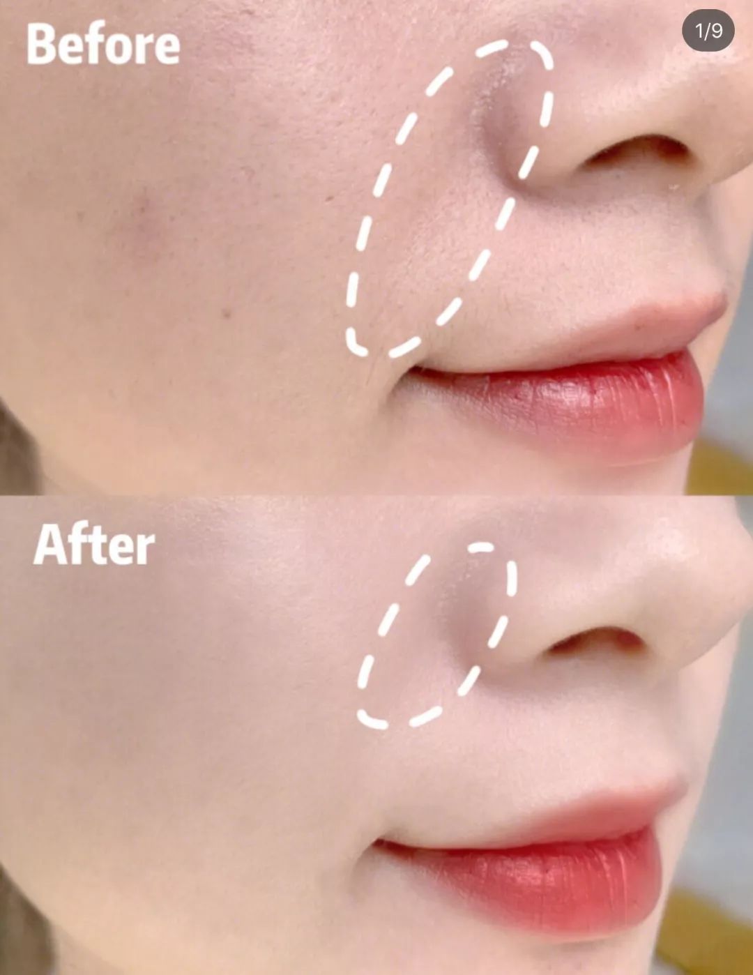 25岁必须用眼霜了吗,25岁之后合适用什么眼霜