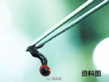 2岁小孩眼睛上突然长了一颗黑痣,2岁小孩眼皮上长了个红疙瘩