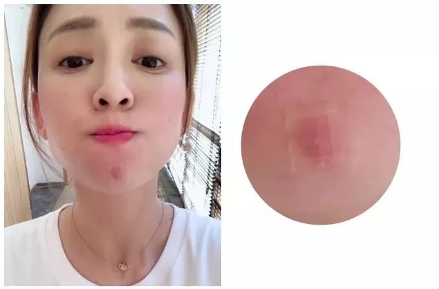 重要场合灰头土脸？16条急救措施帮你焕然一新！