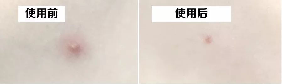 重要场合灰头土脸？16条急救措施帮你焕然一新！