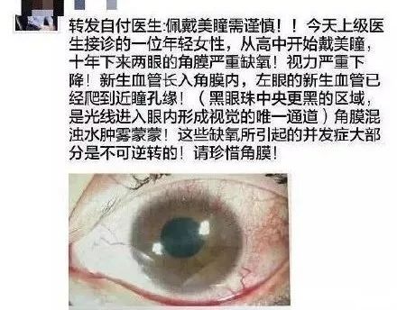 “日本制造”又曝丑闻！违禁成分泛滥，却还有1亿中国人疯抢