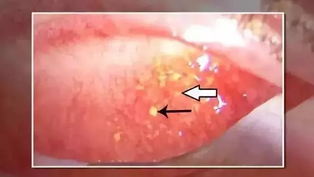 “日本制造”又曝丑闻！违禁成分泛滥，却还有1亿中国人疯抢