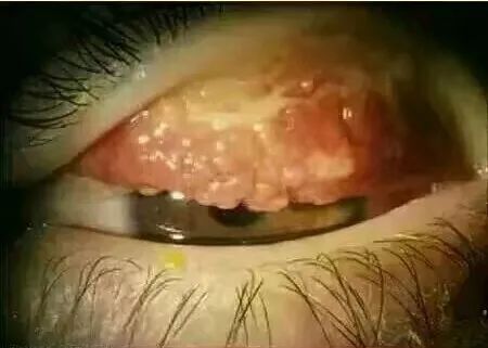 “日本制造”又曝丑闻！违禁成分泛滥，却还有1亿中国人疯抢