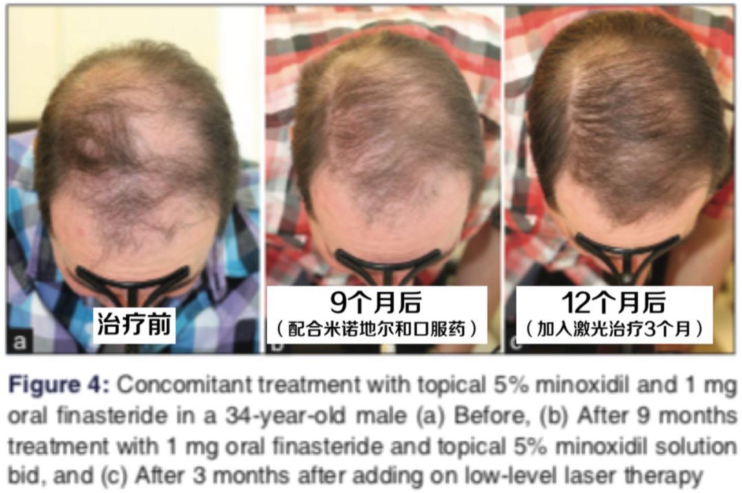 想要「换发型等于换头」？看这简单3步就能够