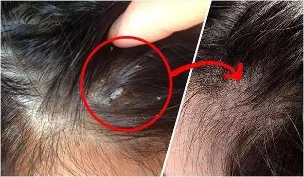 你的头发一天一次还长吗,你的头发那么长不会掉下来吗