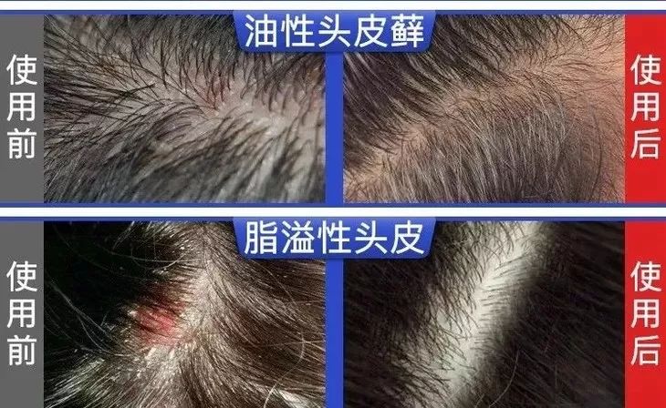 你的头发一天一次还长吗,你的头发那么长不会掉下来吗