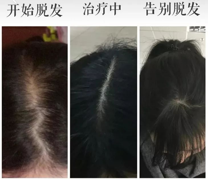 你的头发一天一次还长吗,你的头发那么长不会掉下来吗