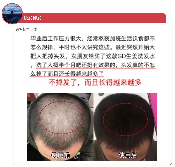 你的头发一天一次还长吗,你的头发那么长不会掉下来吗