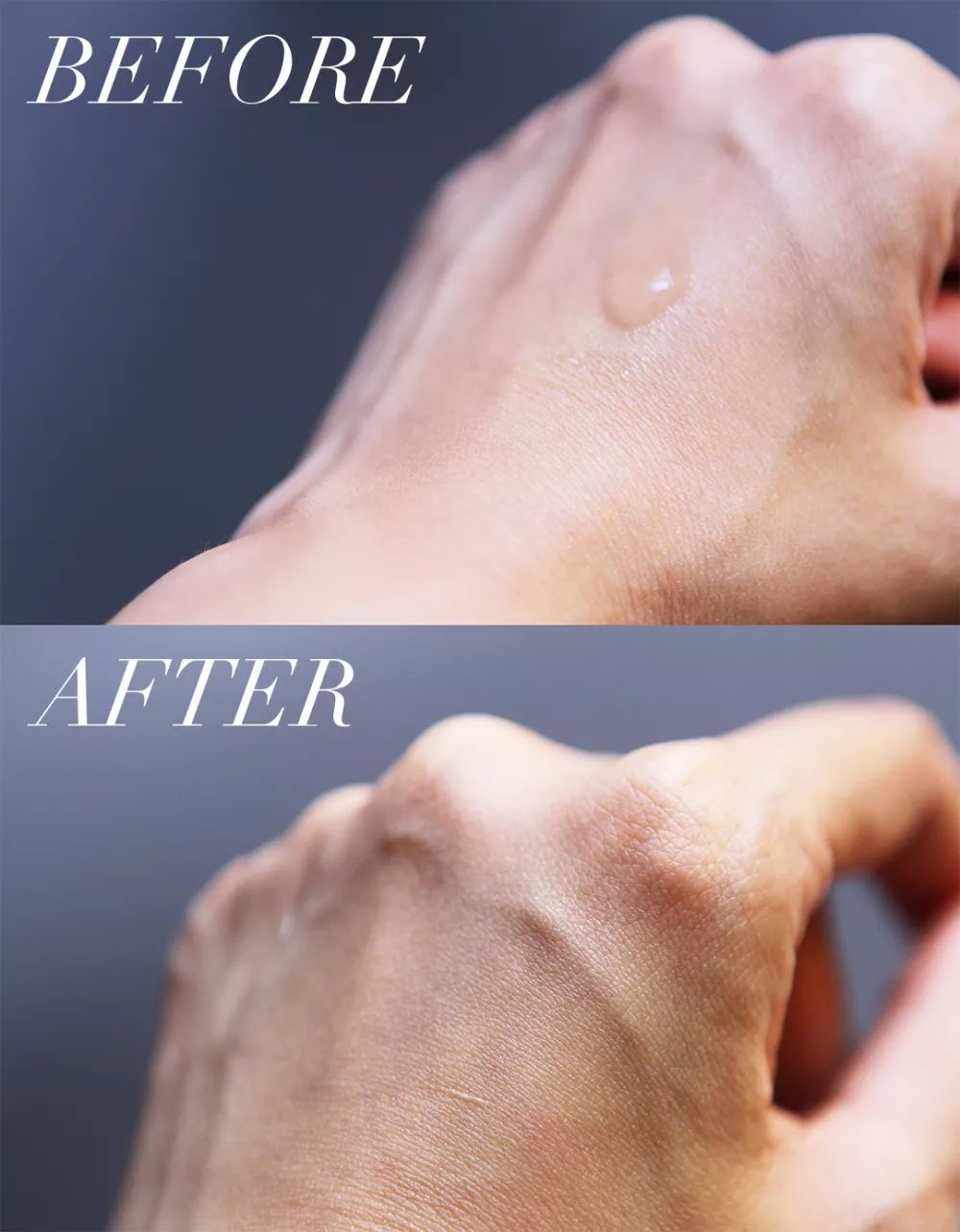 皮肤粗糙暗沉毛孔粗要做什么医美,真正改变毛孔的医美