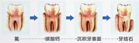 不用打磨牙齿的快速美白方法,不用洗牙能把牙垢黄牙变白的方法