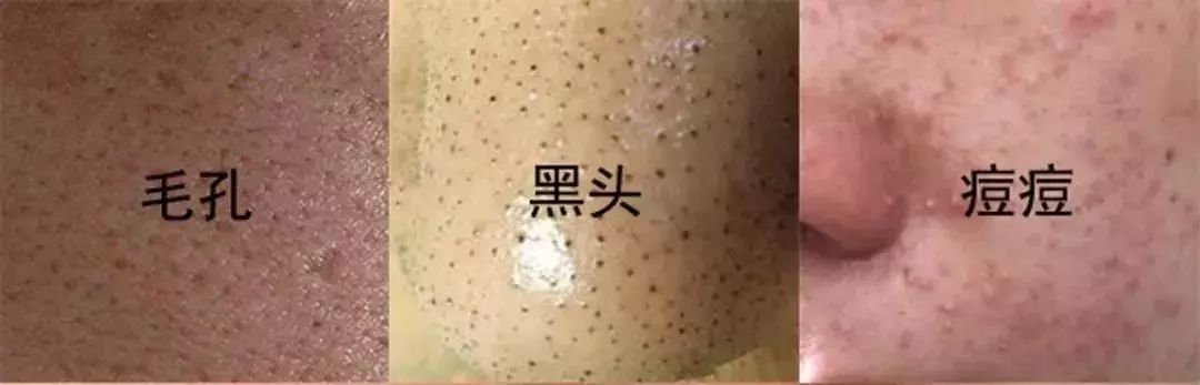 脸上搓出3斤泥！难怪又黄又暗又黑头！10秒给脸蛋“剥壳”，厉害