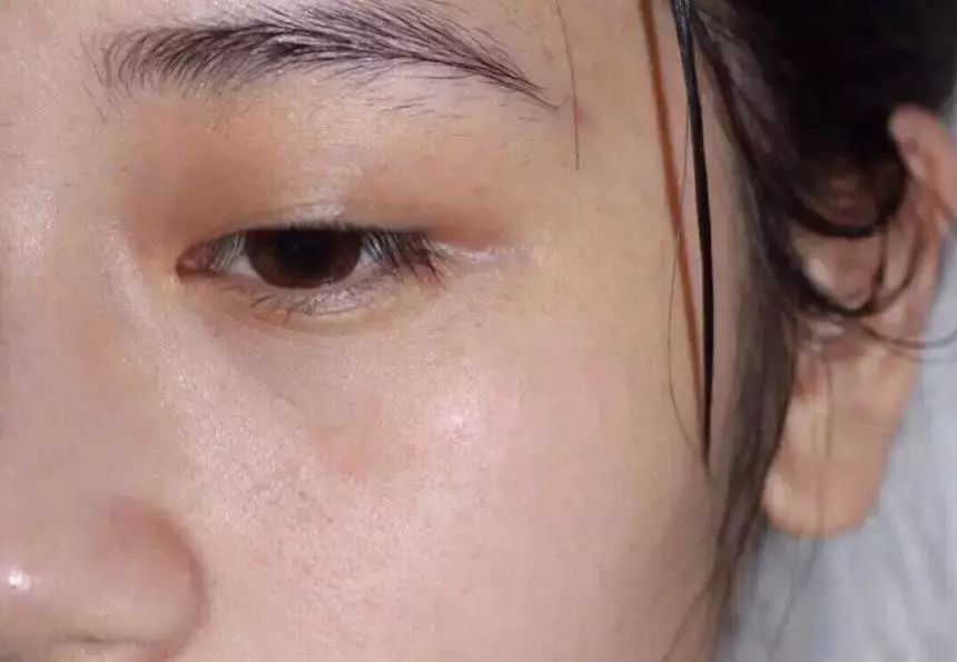 脸上搓出3斤泥！难怪又黄又暗又黑头！10秒给脸蛋“剥壳”，厉害