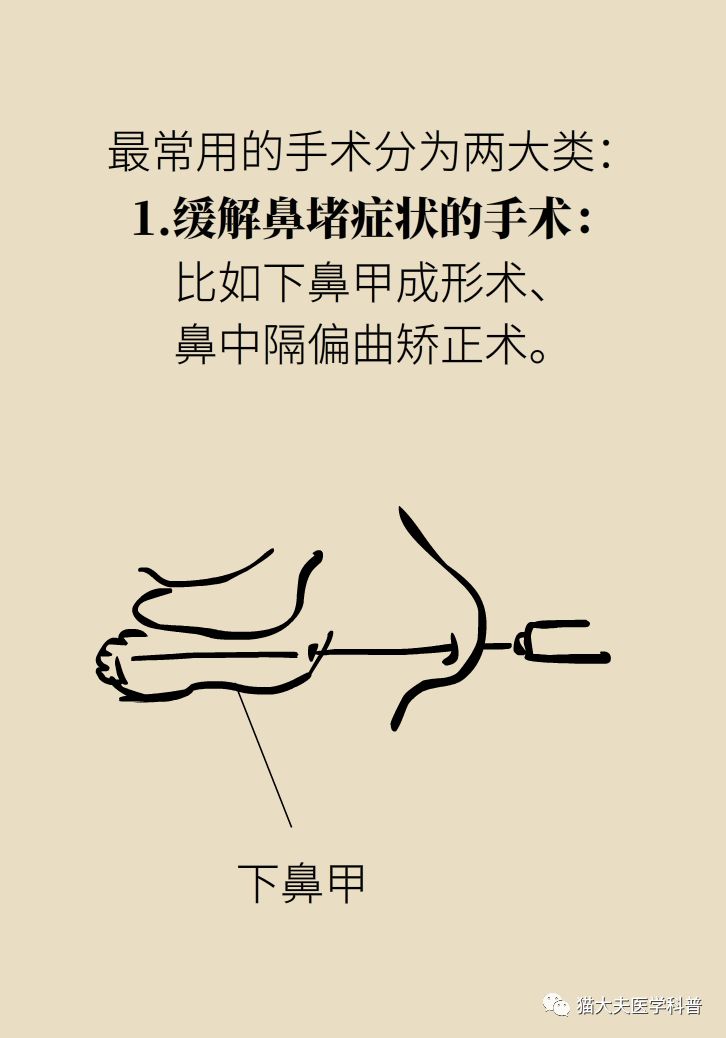 治疗过敏性鼻炎最好的神器,过敏性鼻炎三板斧