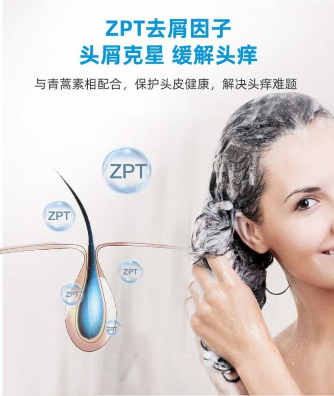 头皮发痒爱出油是什么引起的,头皮出油严重痒是什么原因引起的