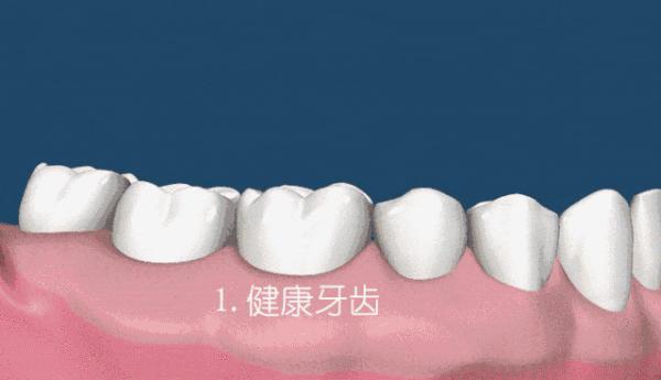 让你口吐芬芳的清新口气牙膏,刷牙口气清新又健康的牙膏