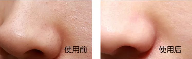 娆ц幈闆呯敺澹礂闈㈠ザ鎺ф补鐐埥娴嬭瘎,娆ц幈闆呮帶娌圭偔鐖芥礂闈㈠ザ鐢峰コ閫氱敤