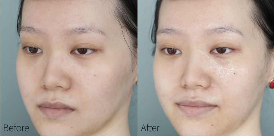 蒂佳婷哪款面膜合适晒后使用,drjart蒂佳婷紫色面膜使用方法