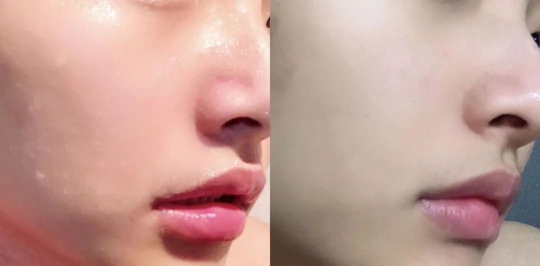 麻范儿好物|波兰国宝级面膜，堪称比“晒后美白针”，每片含有3.6斤羊奶精华