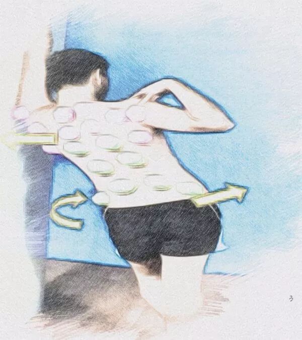 拔罐能够搞定哪些小毛病,拔罐疗法的适应症和功能