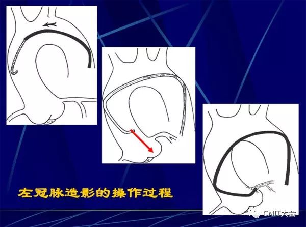 跟我学技术分析从入门到精通,跟我学技术
