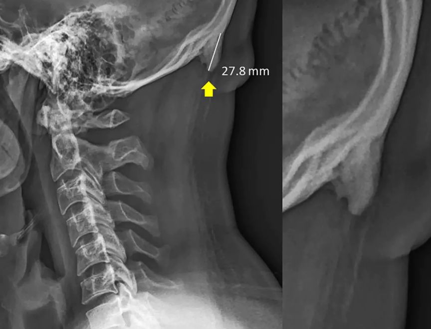 手机看多了脑袋会晕吗,手机看多了把脑子给看坏