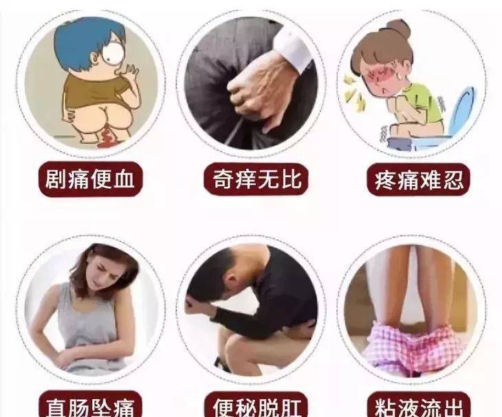 治痔疮最佳的偏方有效的痔疮膏,第一次得痔疮轻微的痔疮膏推荐