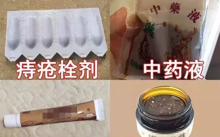 治痔疮最佳的偏方有效的痔疮膏,第一次得痔疮轻微的痔疮膏推荐