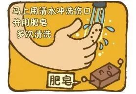 被狗咬了千万可别咬回去,被狗咬的很严重该怎么办