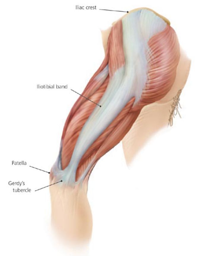 璺戞鑰呰啙,璺戞鑰呰啙鐤兼槸鎬庝箞鍥炰簨