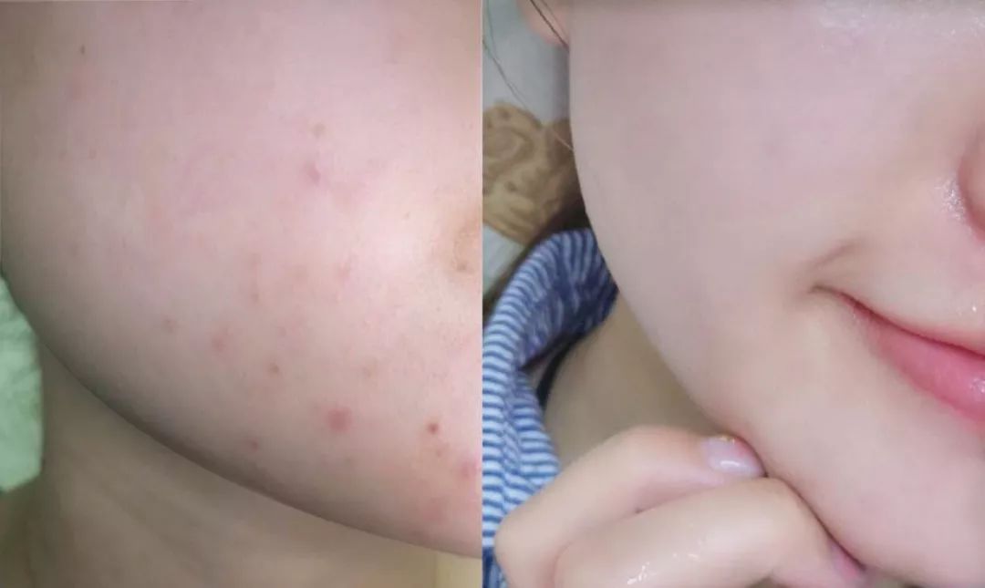 用它泡脚能赶走5种病,一个泡脚小药方赶走多种病