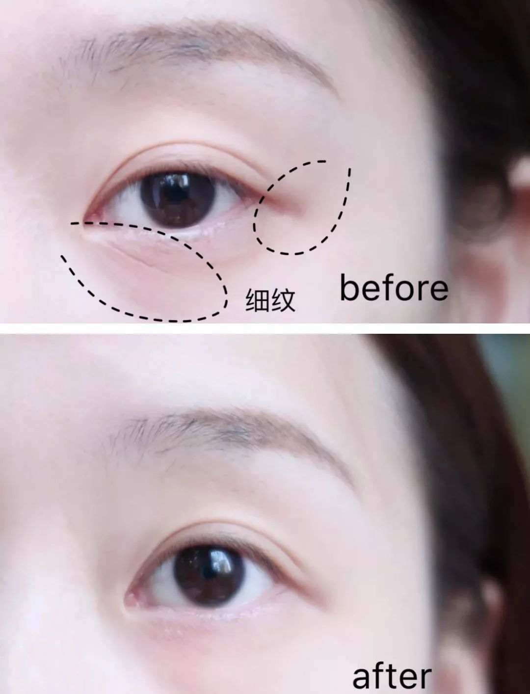 眼膜贴八小时紧致抗皱淡细纹,官方眼膜紧致抗皱淡细纹法令纹