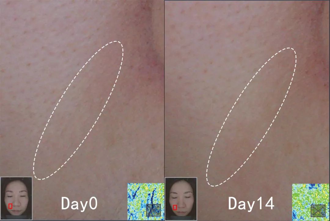 盲测|微整不急!先试试黑科技抗老面霜