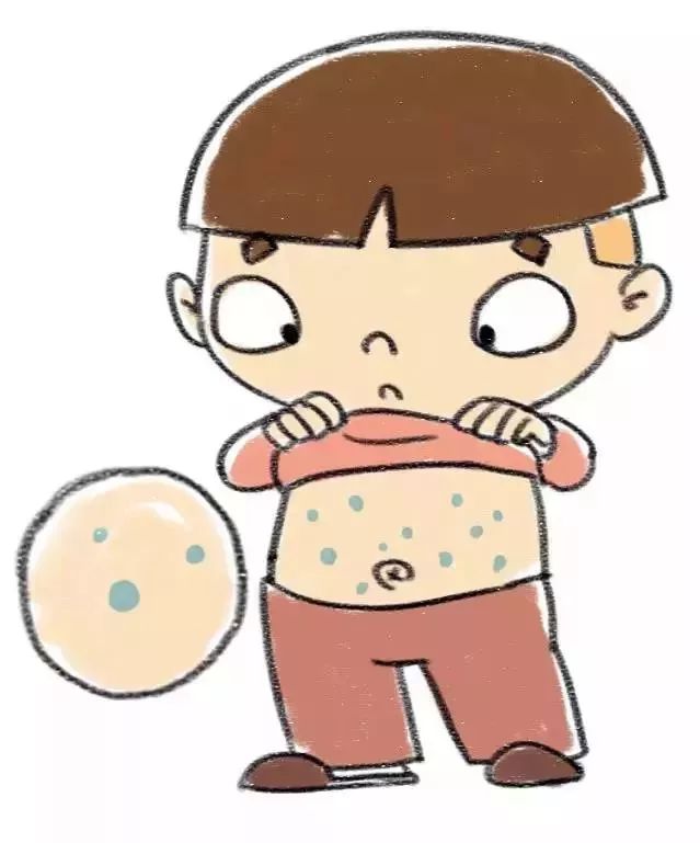 水痘高发期要注意什么,水痘进入高发期行家支招如何预防